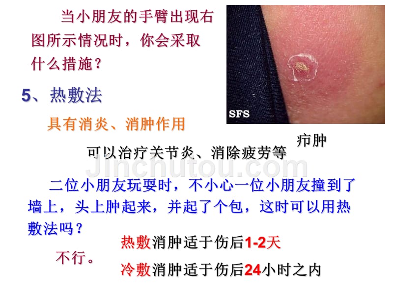 预防常见病之常用护理技术及急救术幻灯片_第4页