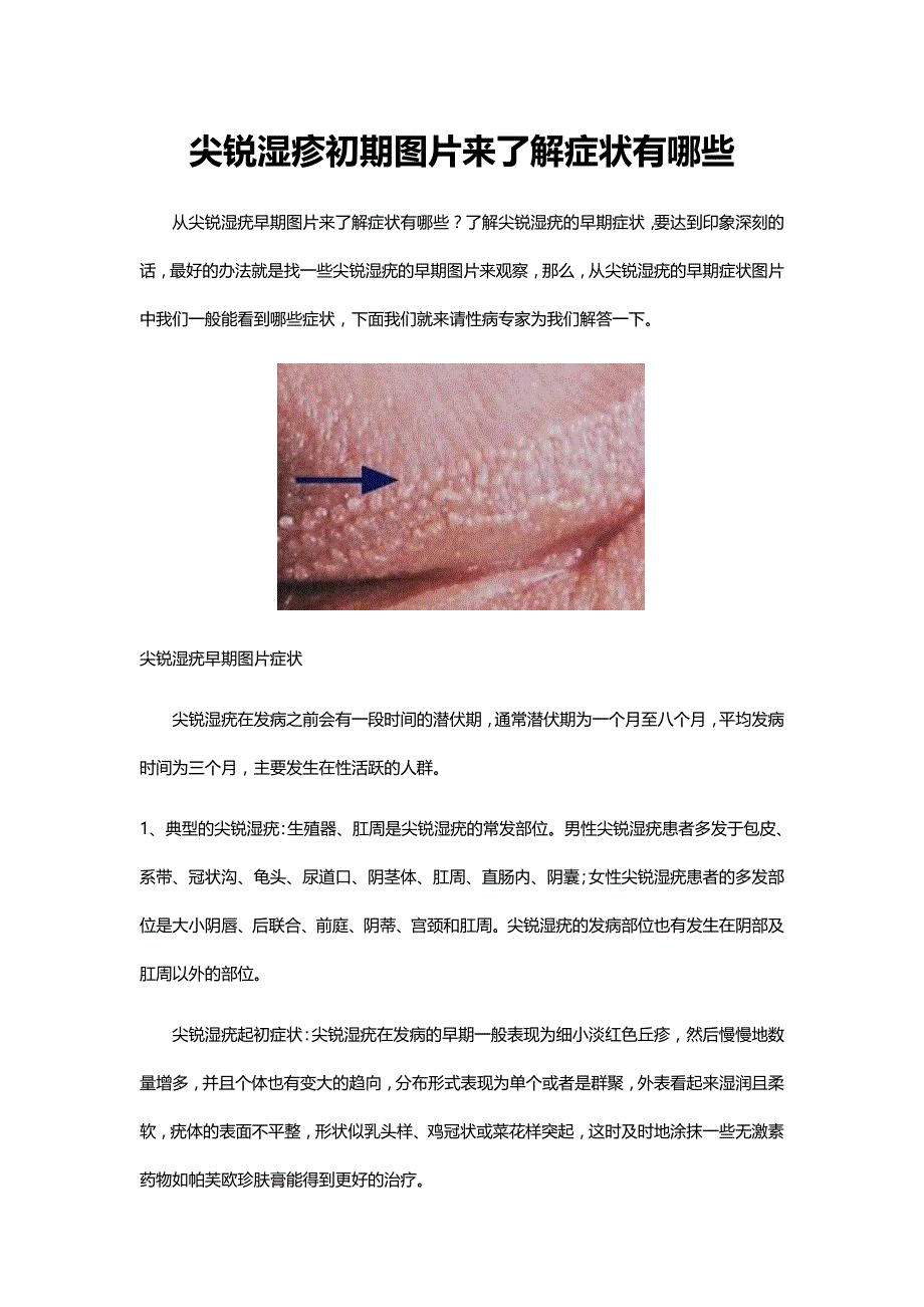 【2017年整理】尖锐湿疹初期图片来了解症状有哪些_第1页