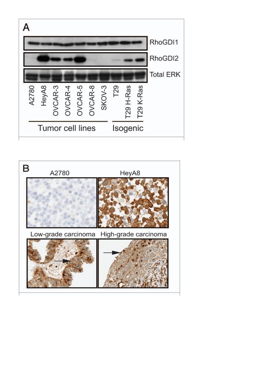 RhoGDI2 antagonizes ovarian carcinoma growth, invasion and metastasis_第3页