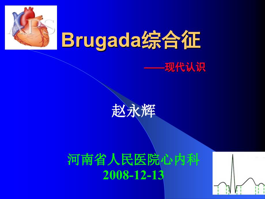 Brugada综合征4_第1页