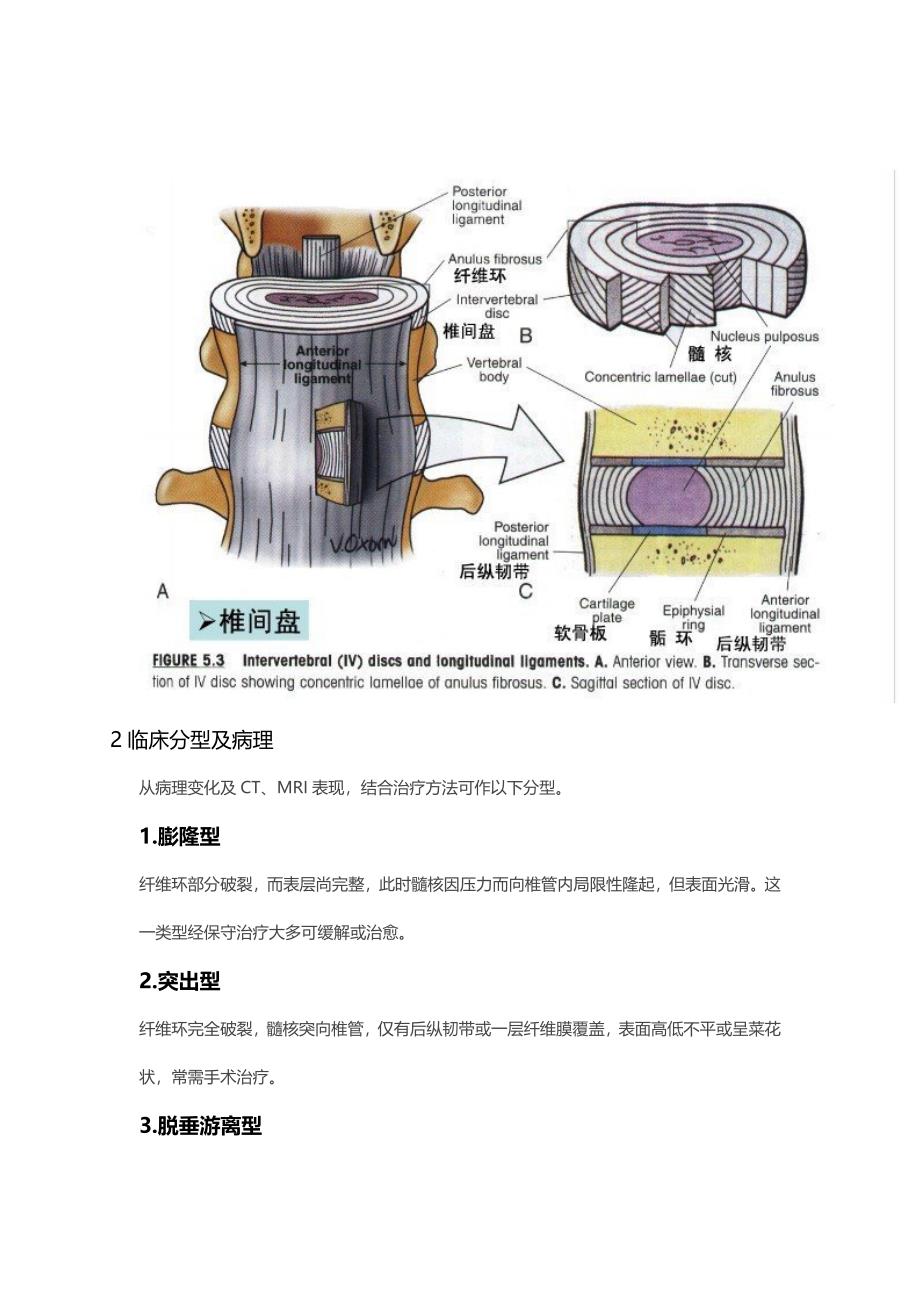 腰椎加脘与盘突出的原因和治疗方法_第3页