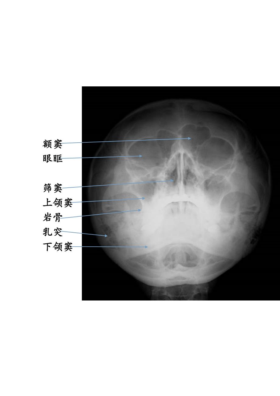 头颅X线摄影_第4页