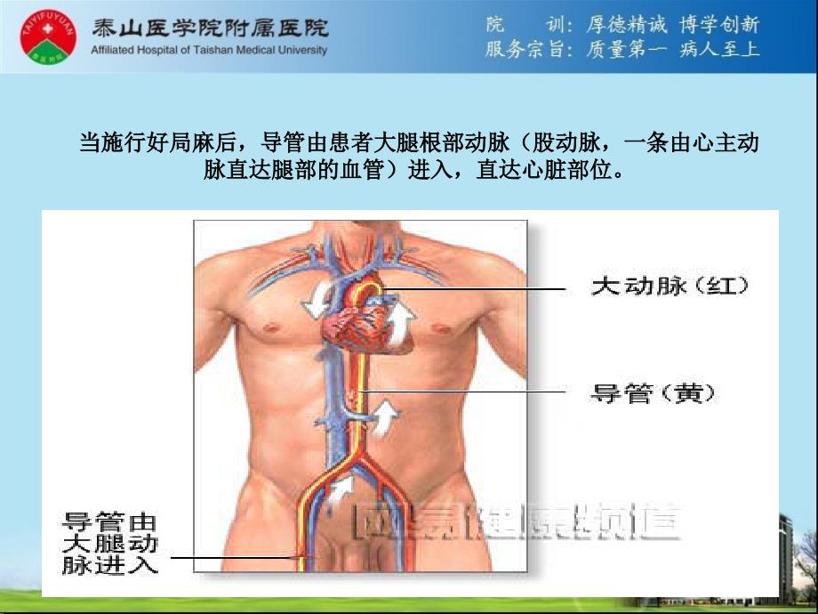 赵强：PCI术后并发症原因_第2页