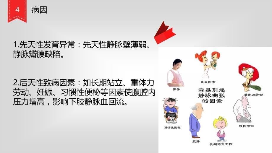 静脉曲张  ppt_第5页