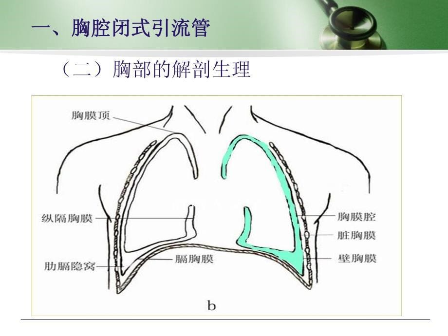 胸外科管路护理-周翠玲_第5页