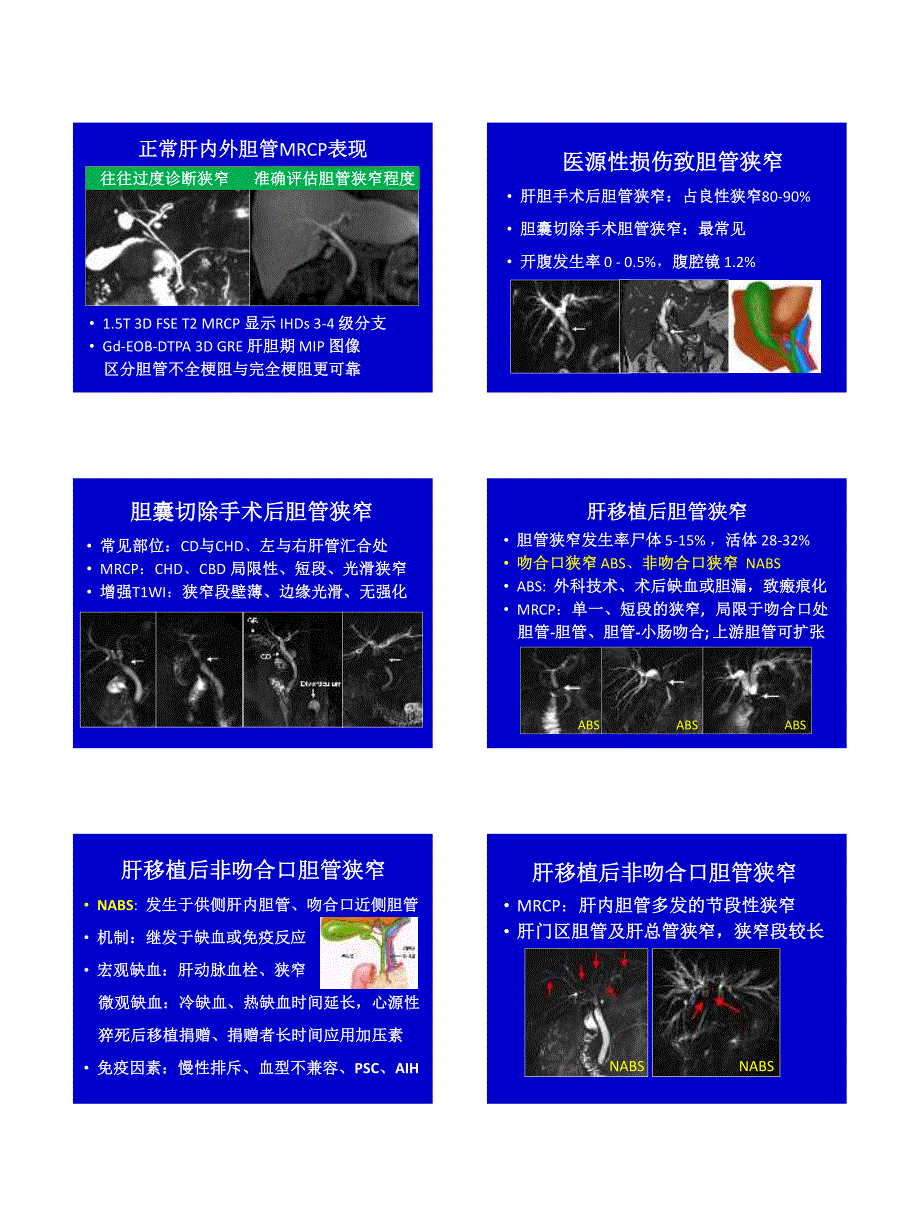 胆管狭窄的诊断思路_第2页