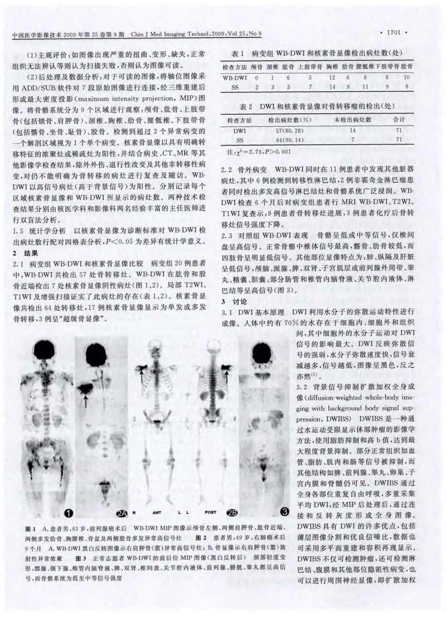 全身弥散加权成像观察骨转移瘤_第2页