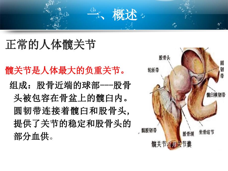 全髋关节置换术的教学查房_第3页