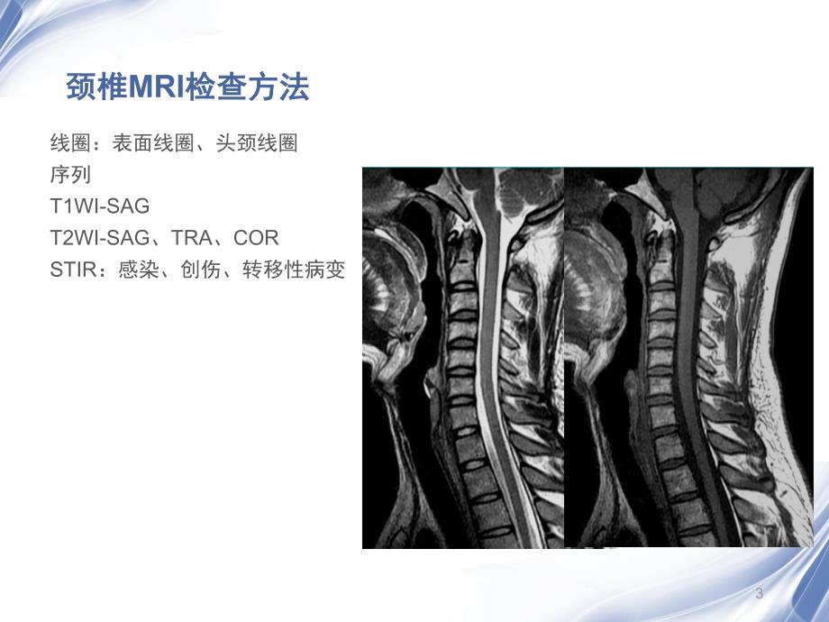 脊柱MR诊断1_第3页