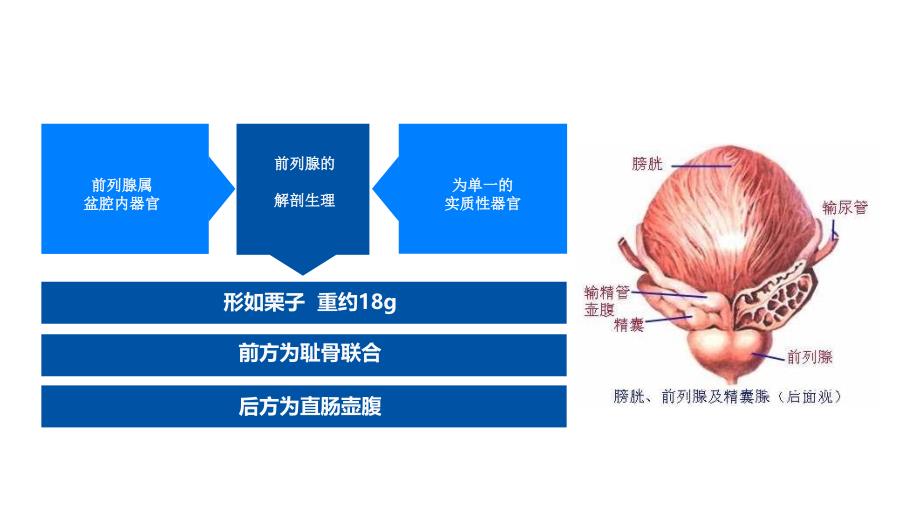 腹腔镜下前列腺癌_第3页