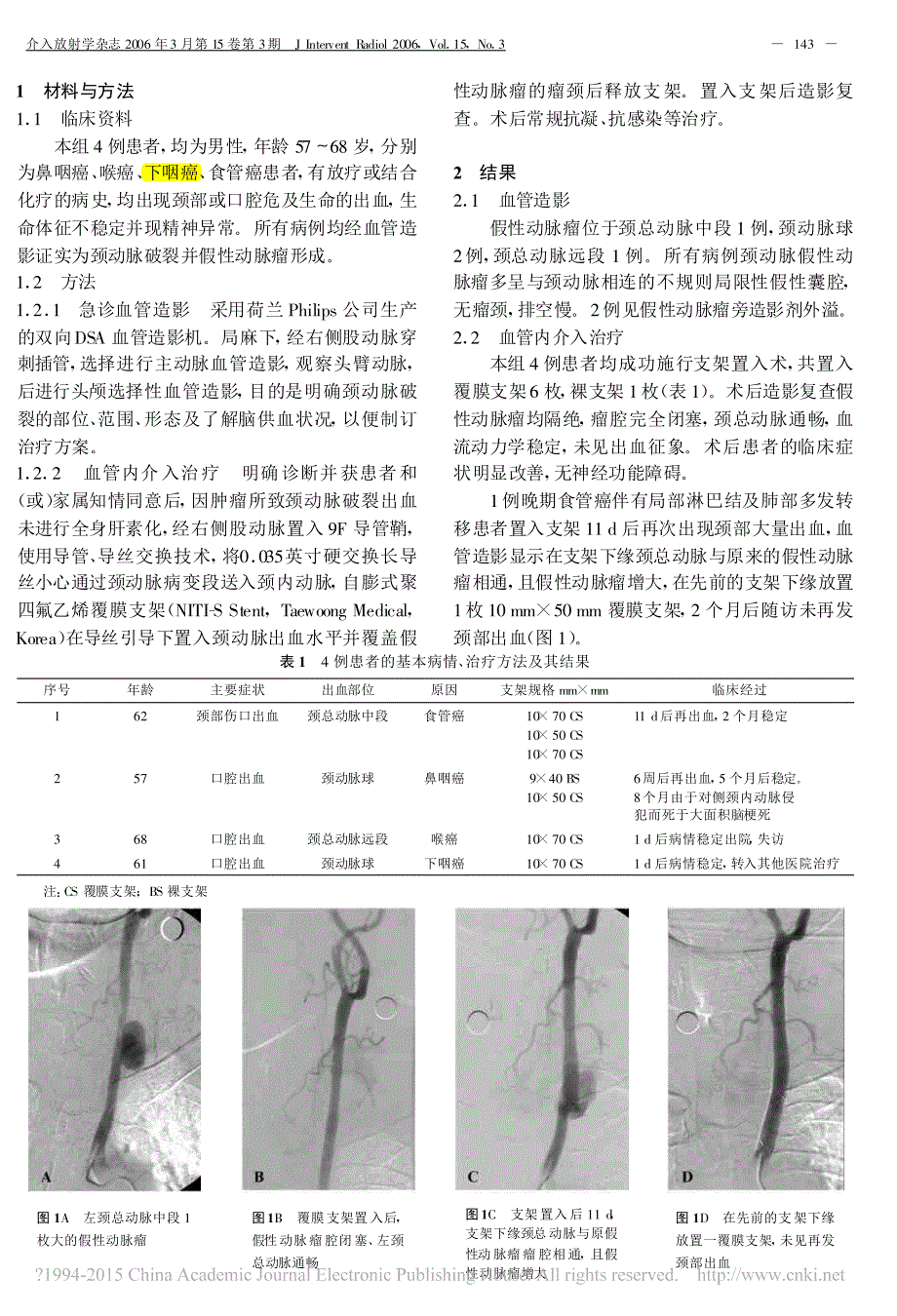 应用覆膜支架介入救治颈动脉破裂并假性动脉瘤2006_徐高峰_第2页