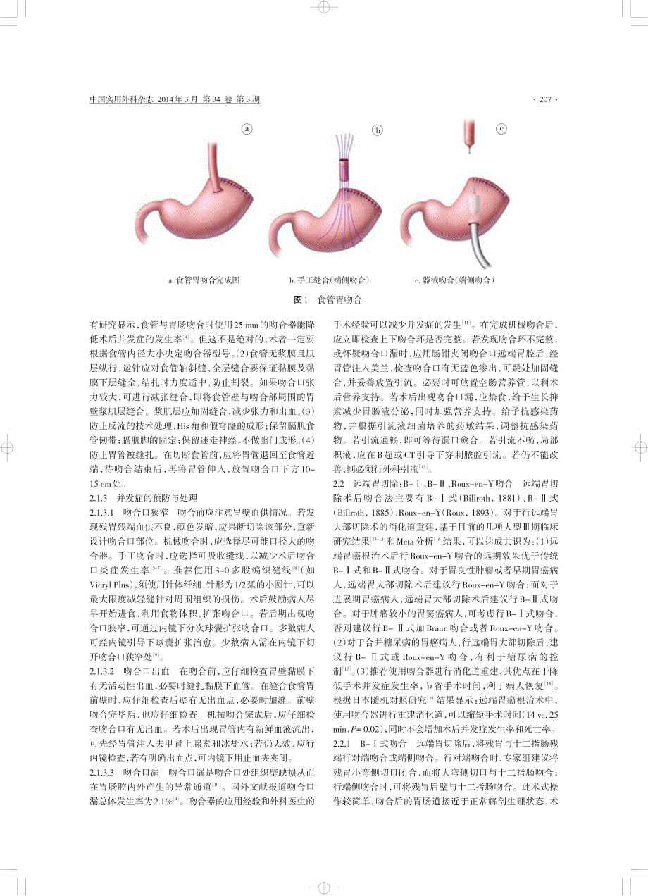 【最新】+胃切除术后消化道重建技术专家共识_第3页