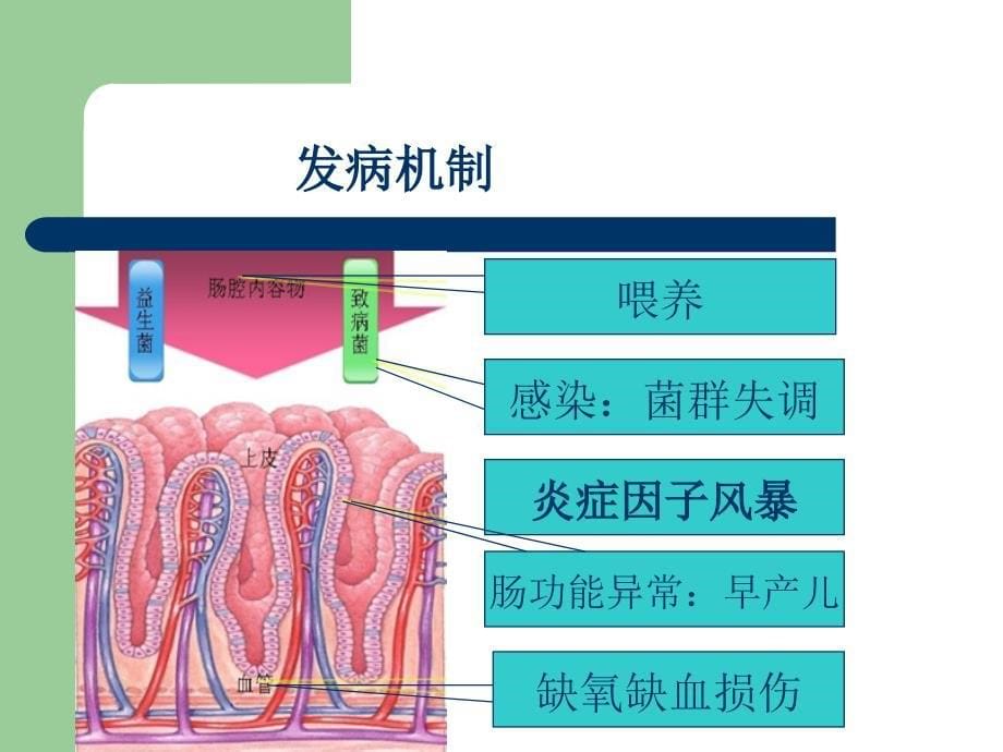 新生儿坏死性小肠结肠炎  方成志_第5页