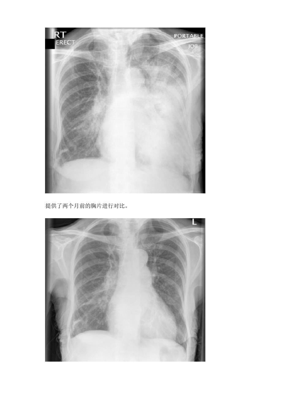 胸部 X 光片：阅片必备指南_第5页