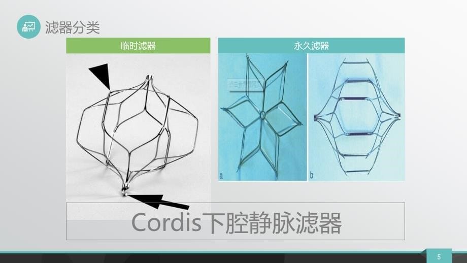 腔静脉滤器置入_第5页