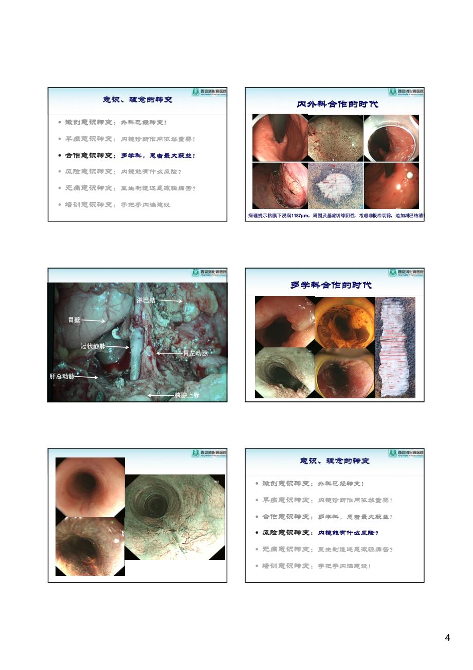 内镜微创诊疗的意识转变_第4页