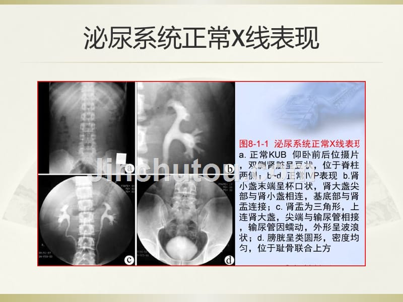 【2017年整理】八泌尿生殖系统和腹膜后间隙断层解剖_第4页