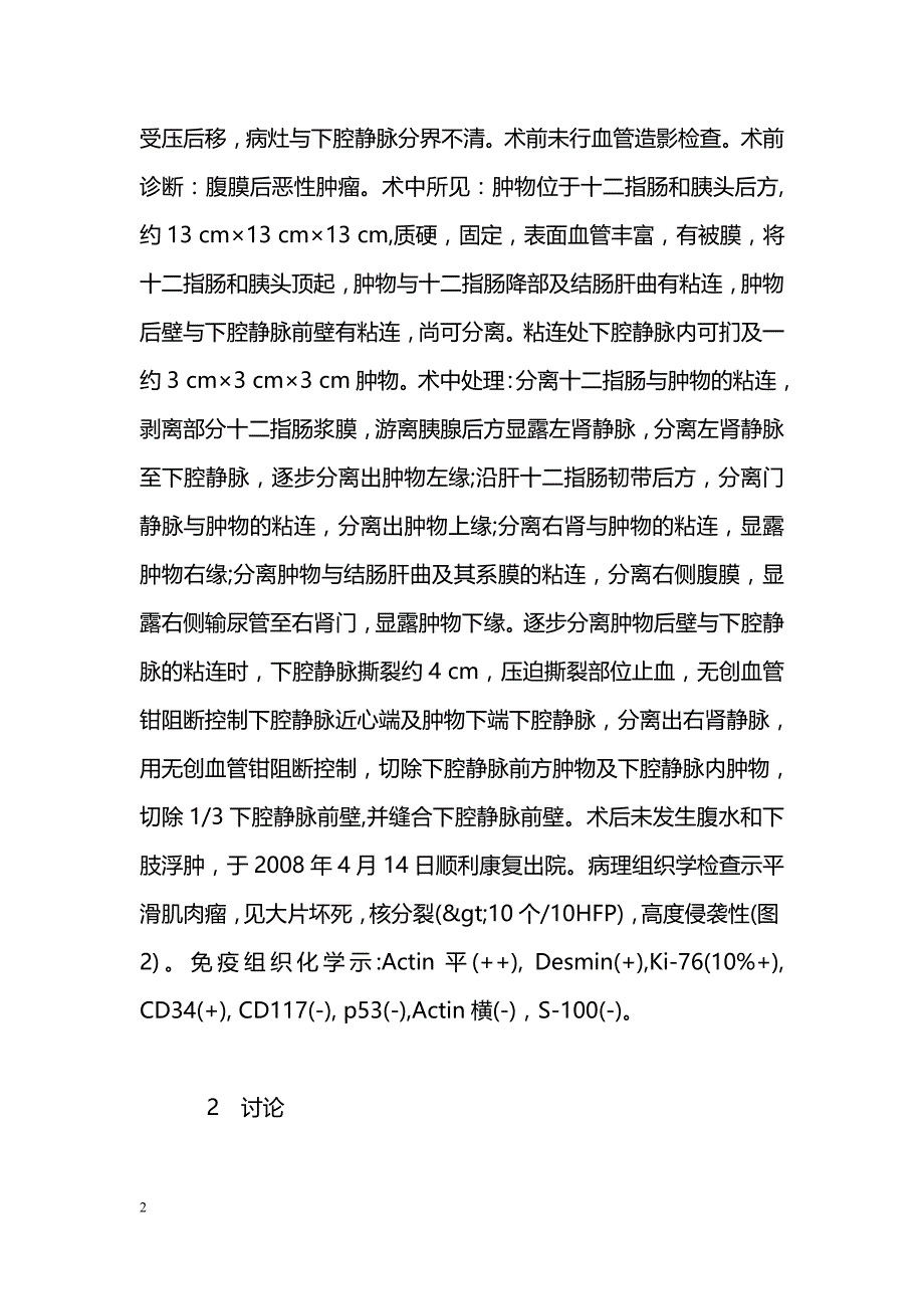 原发性下腔静脉平滑肌肉瘤一例_第2页