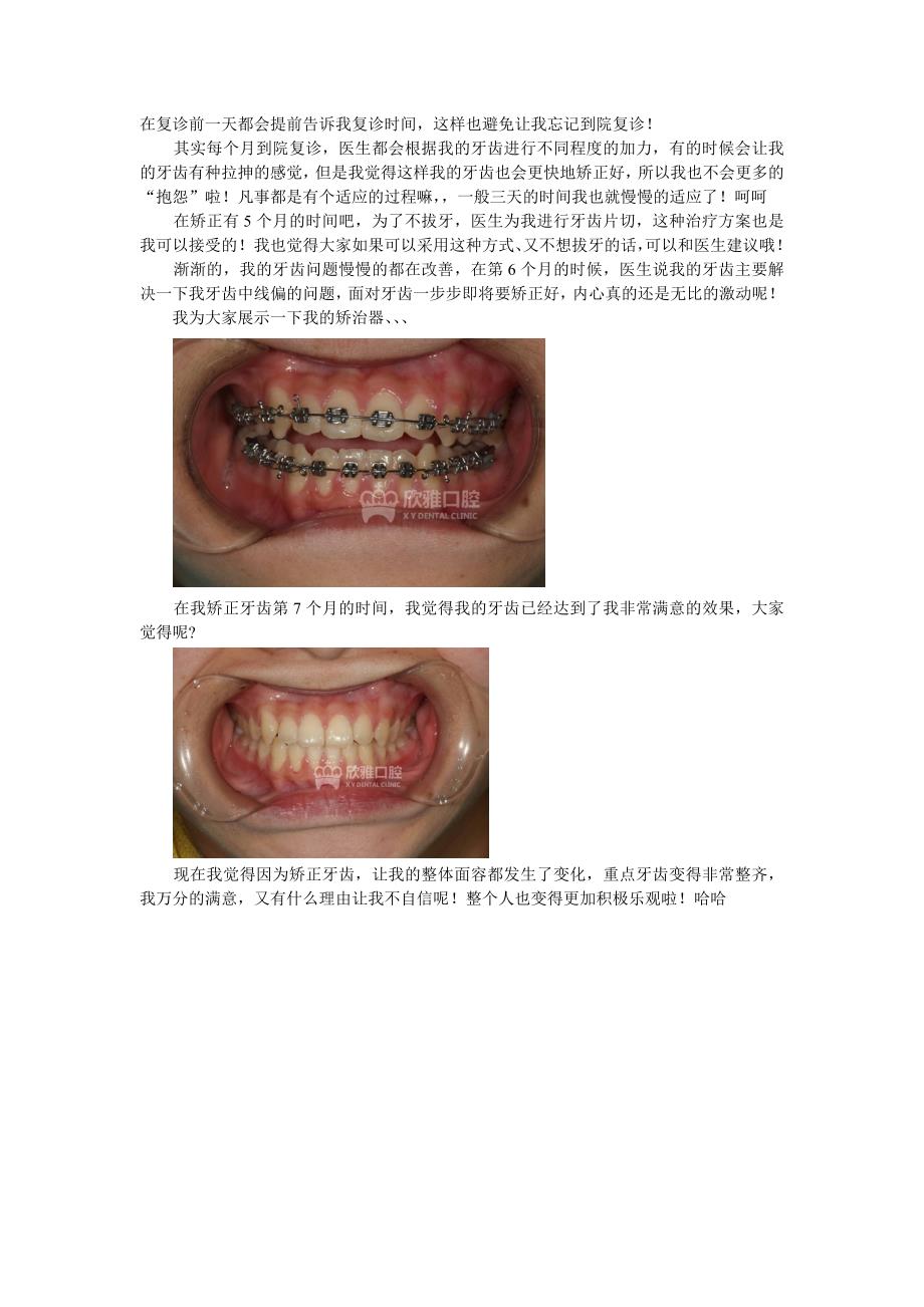 牙齿矫正给我带来了无限正能量_第2页