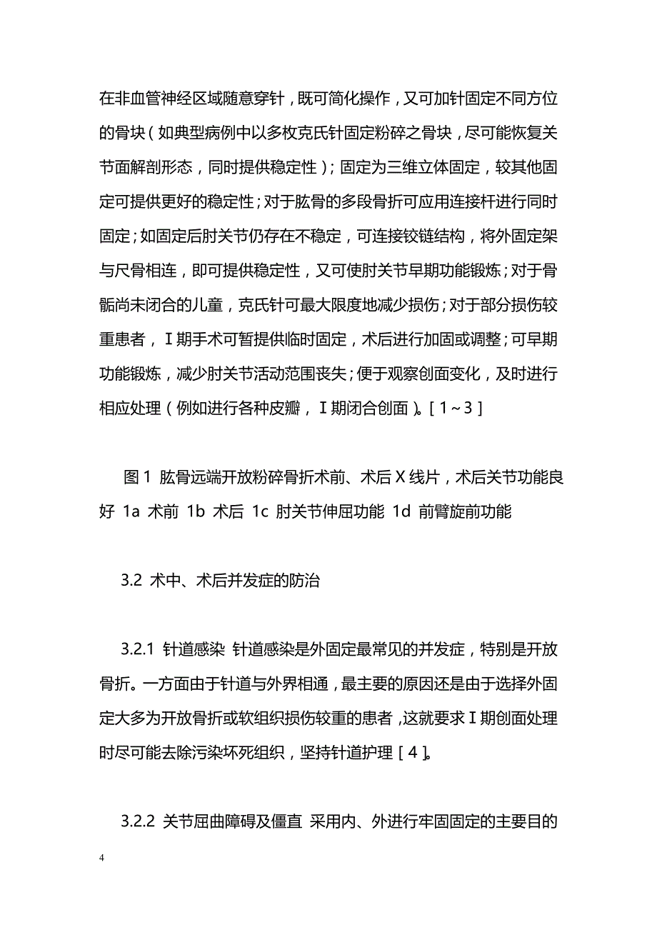 混合式外固定架在肱骨远端粉碎骨折中的应用_第4页