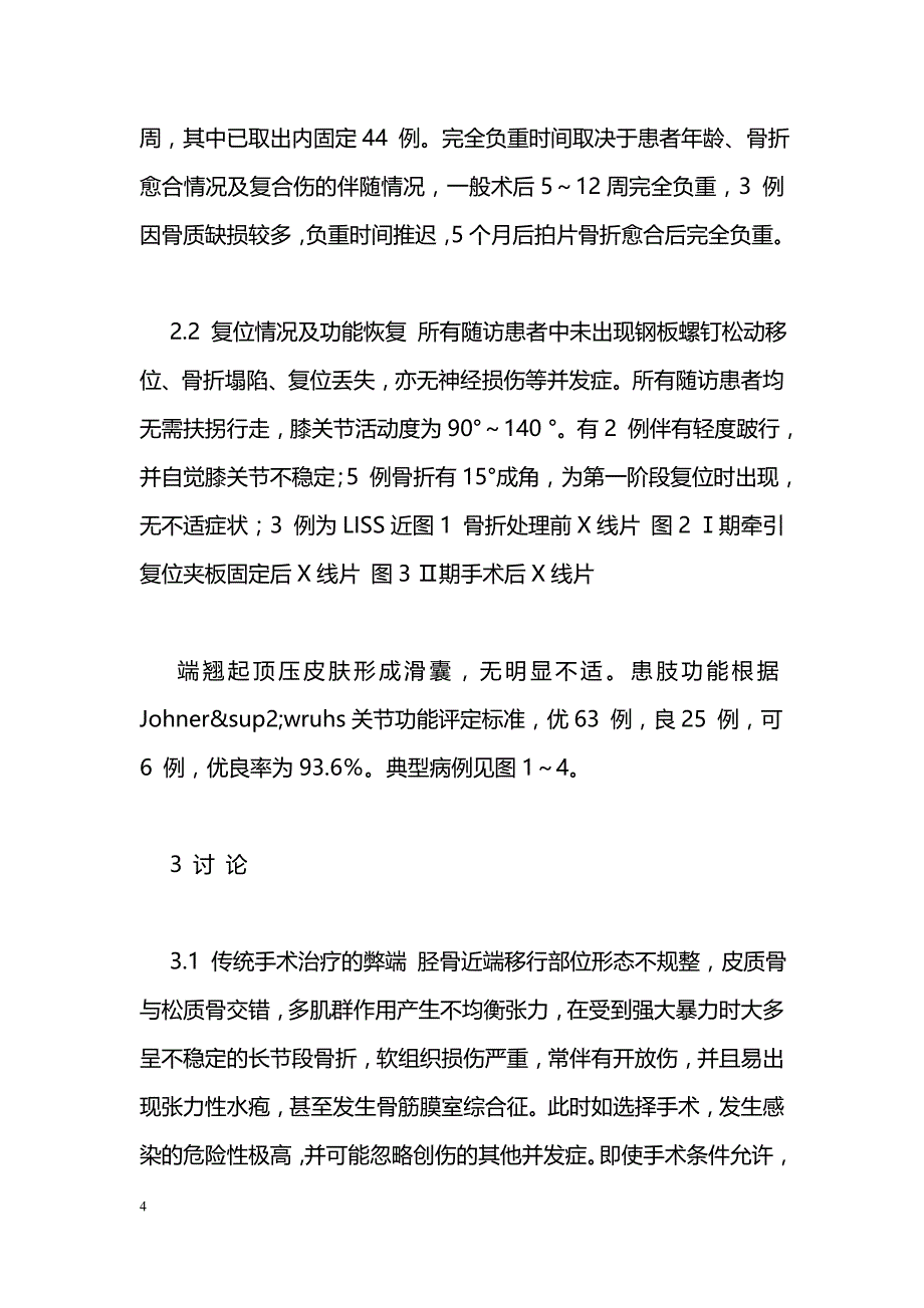 分阶段微创治疗胫骨近端粉碎性骨折_第4页