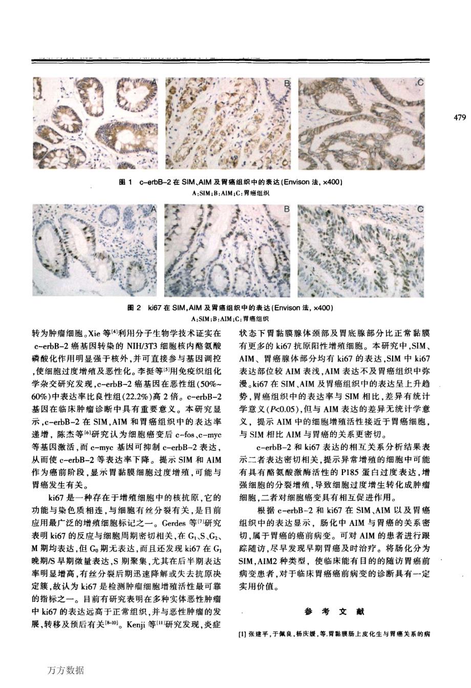 c-erbB-2和ki67在胃黏膜肠上皮化生及胃癌组织中的表达_第3页