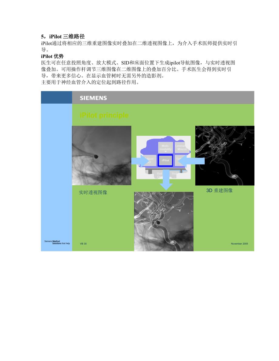 西门子血管机DTA新技术_第4页