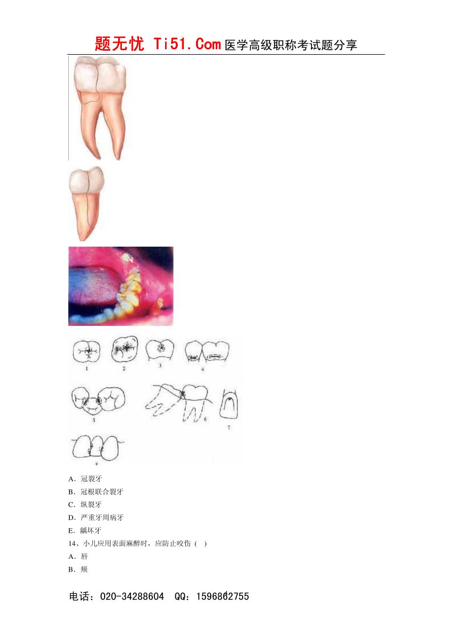 医学高级正副高考试题无忧《口腔颌面外科》辅导习题 七_第4页