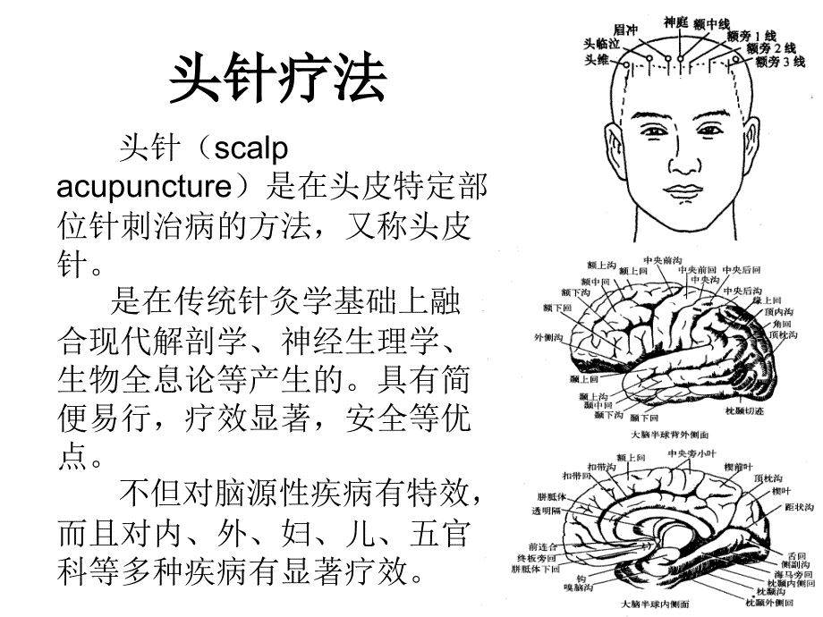 洪杰-国标头针疗法医学课件_第2页