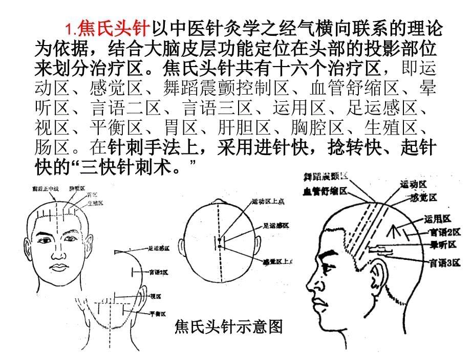 洪杰-国标头针疗法医学课件_第5页