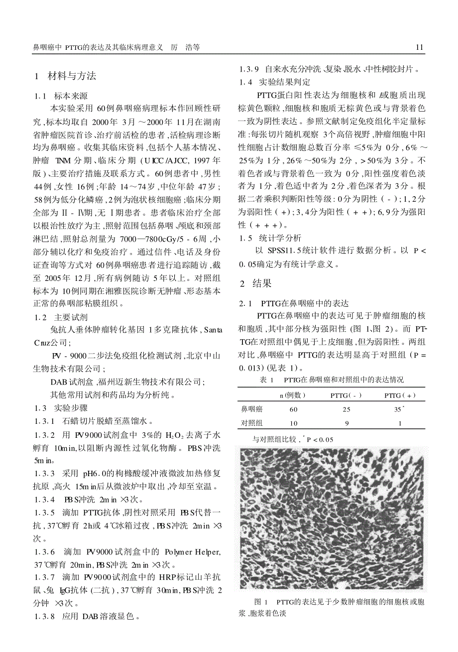 鼻咽癌中PTTG的表达及其临床病理意义_第2页