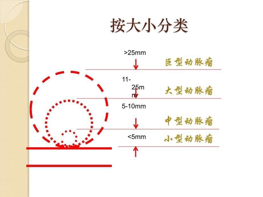 颅内动脉瘤围手术期护理_第5页