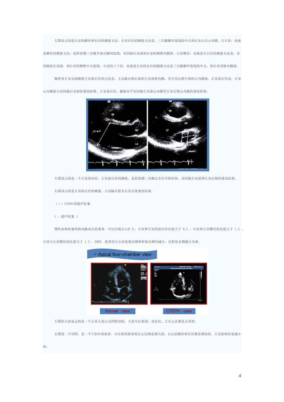 肺血栓栓塞的多普勒超声诊断规范_第4页