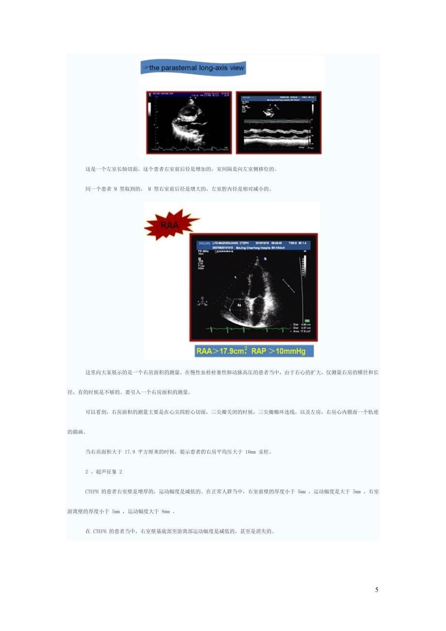 肺血栓栓塞的多普勒超声诊断规范_第5页