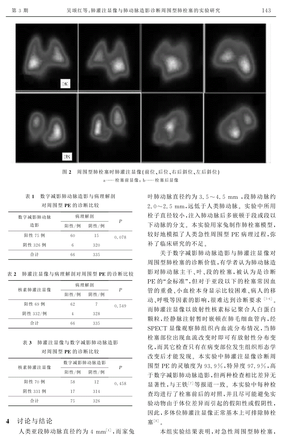 肺灌注显像与肺动脉造影诊断周围型肺栓塞的实验研究_第4页