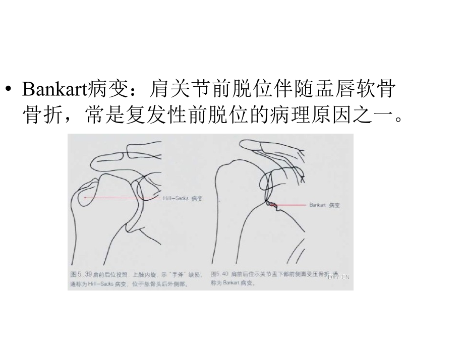 特殊名称骨折俱乐部_第3页