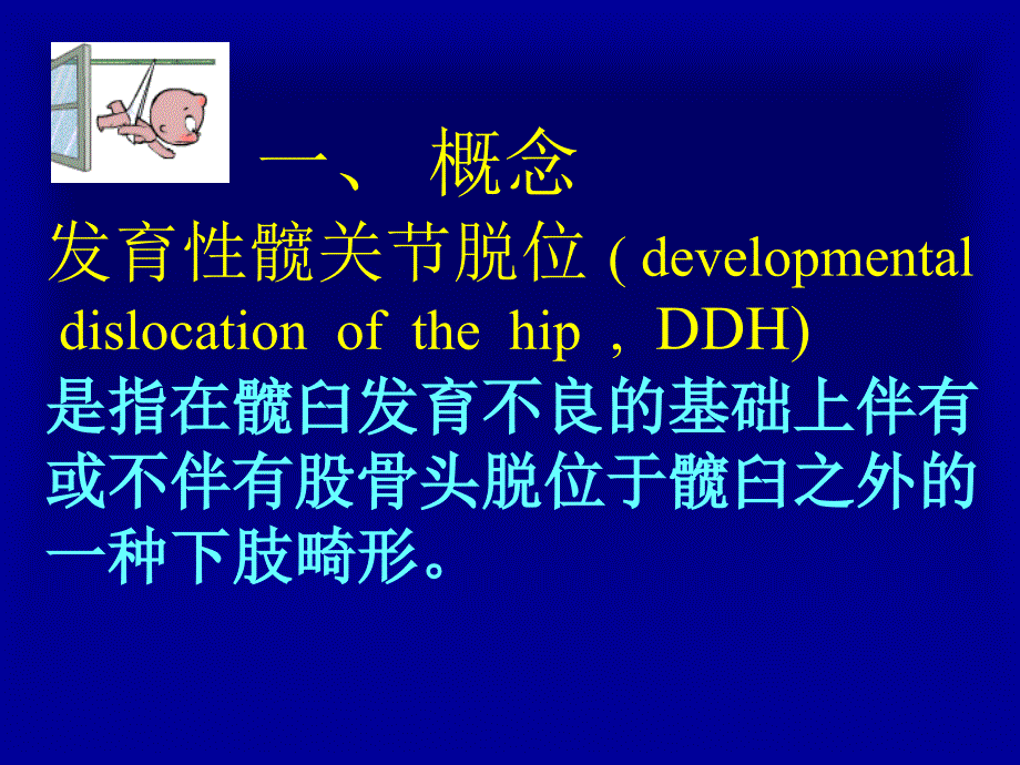 外科学课件 发育性髋关节脱位髋臼发育不良的病理变化_第2页