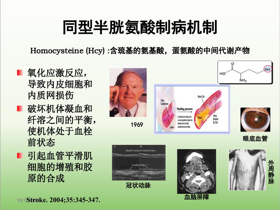 H型高血压防治措施_第2页