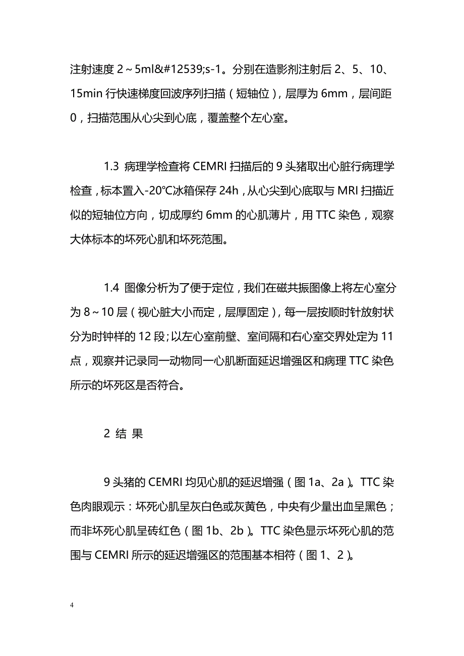 对比剂增强的磁共振显像对心肌梗死后坏死心肌的检测_第4页