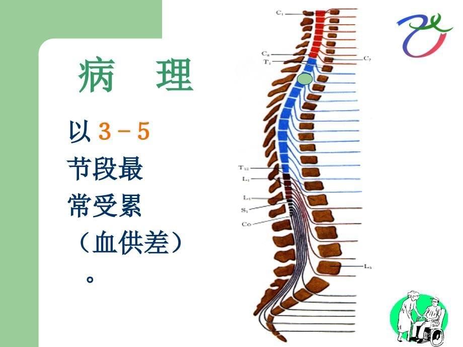 急性脊髓炎.ppt_第5页