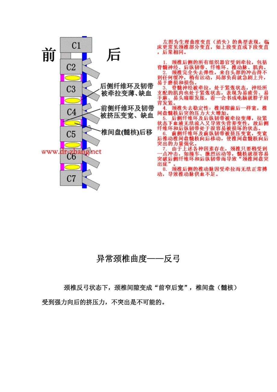 颈椎病病理保健治疗汇编3_第5页