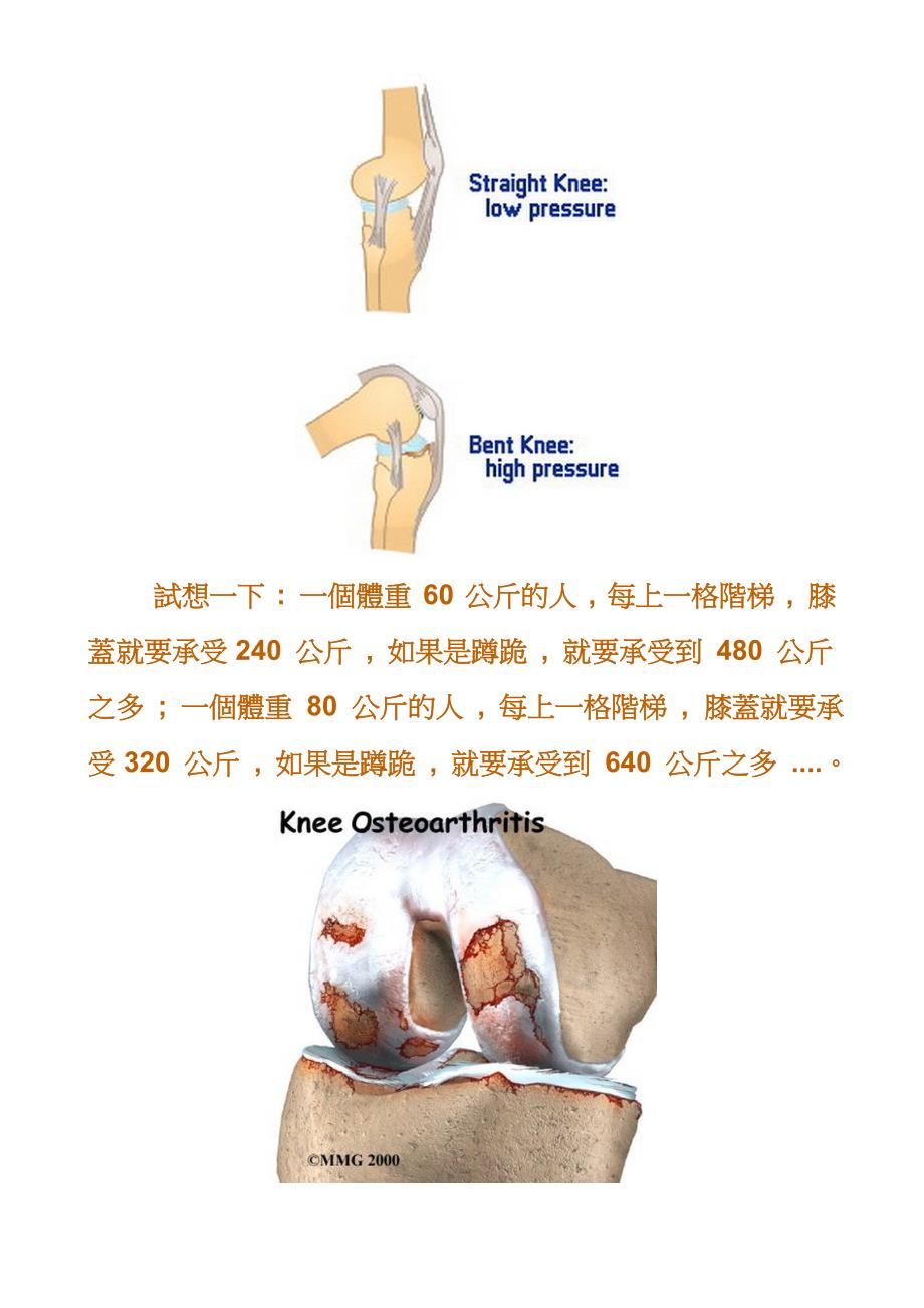 如何运动不伤膝 - CHTr_第4页