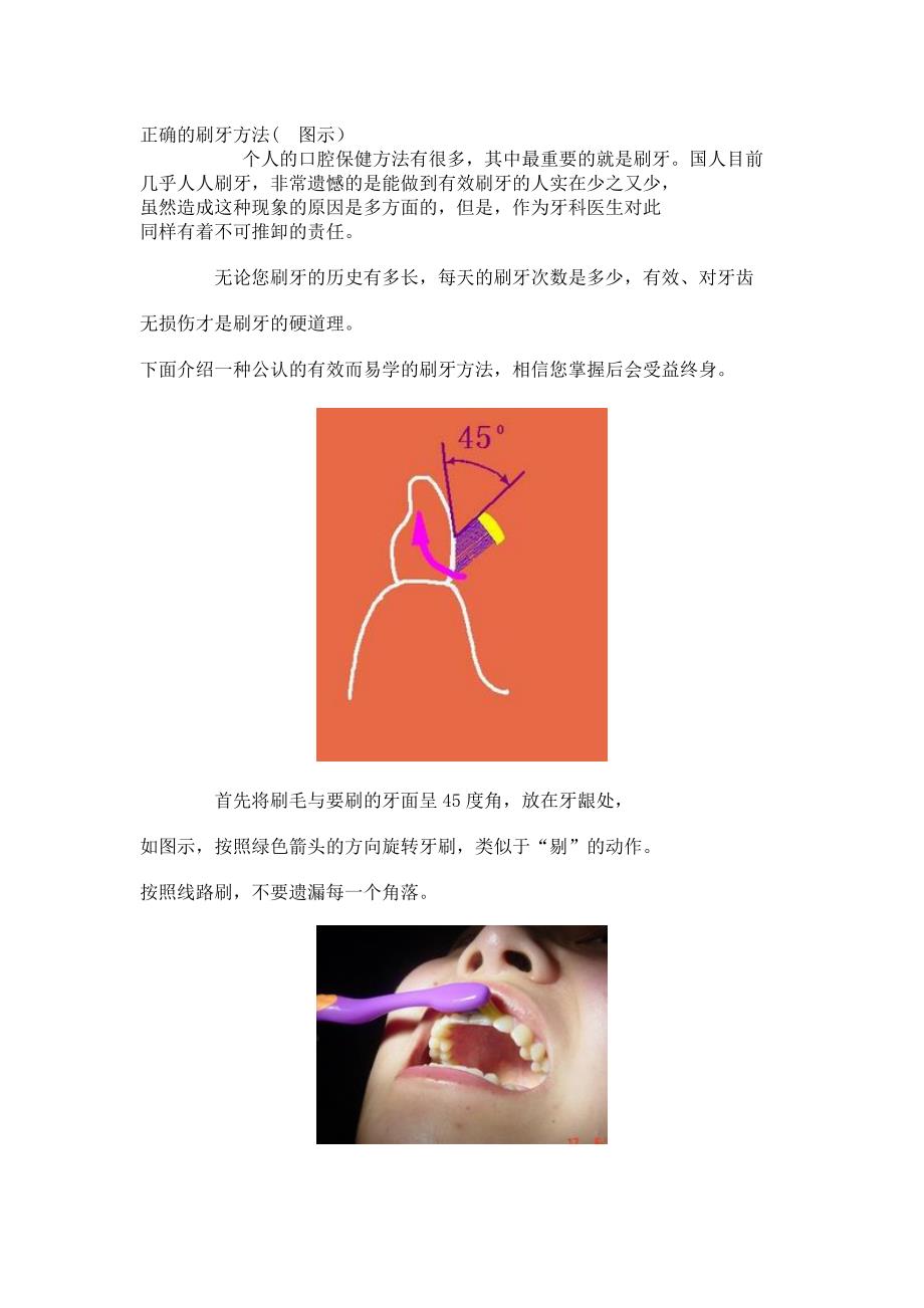 正确的刷牙方法(图示)_第1页