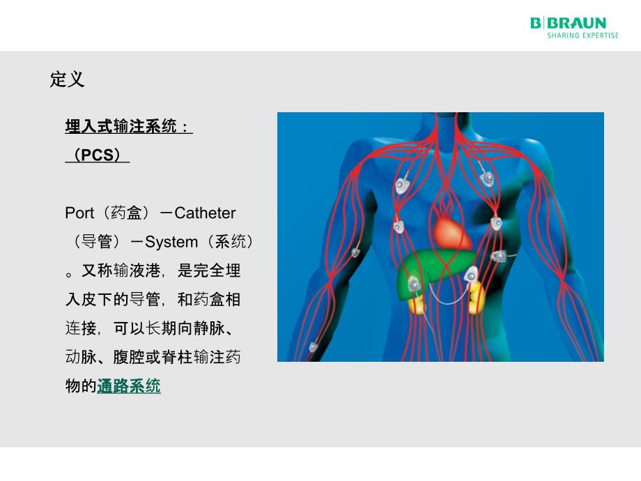 埋入式输注系统之椎管内通路药盒_第4页