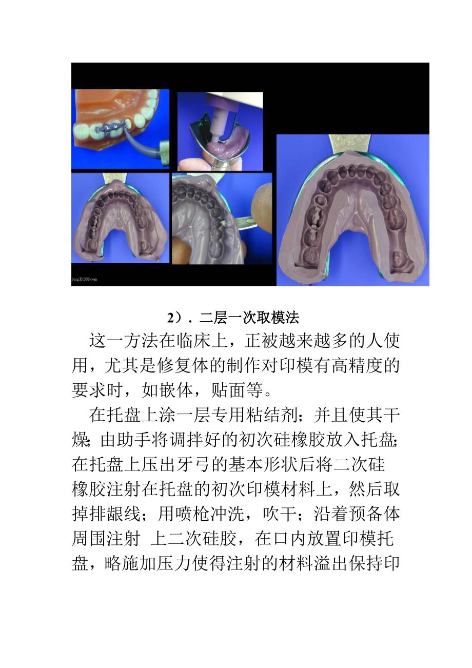 如何取得口腔精细印模(一)_第2页