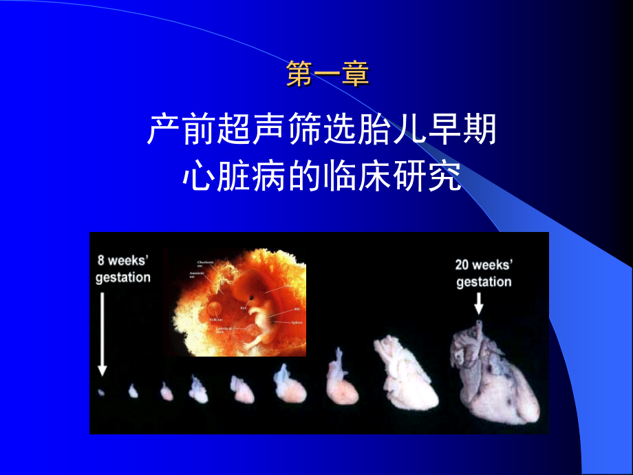 产前超声筛选胎儿心脏病新技术_第4页