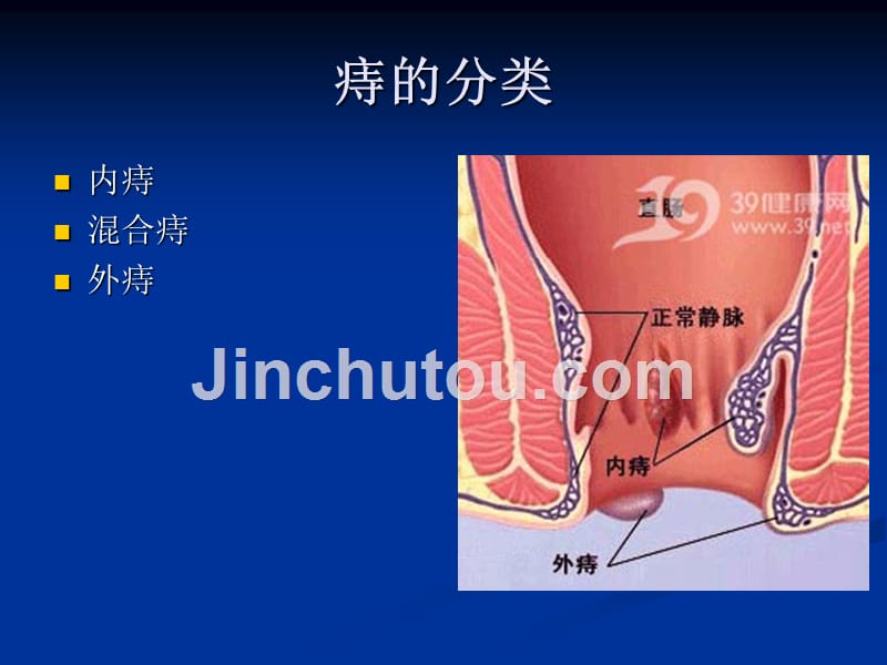 Hemoroid_第4页