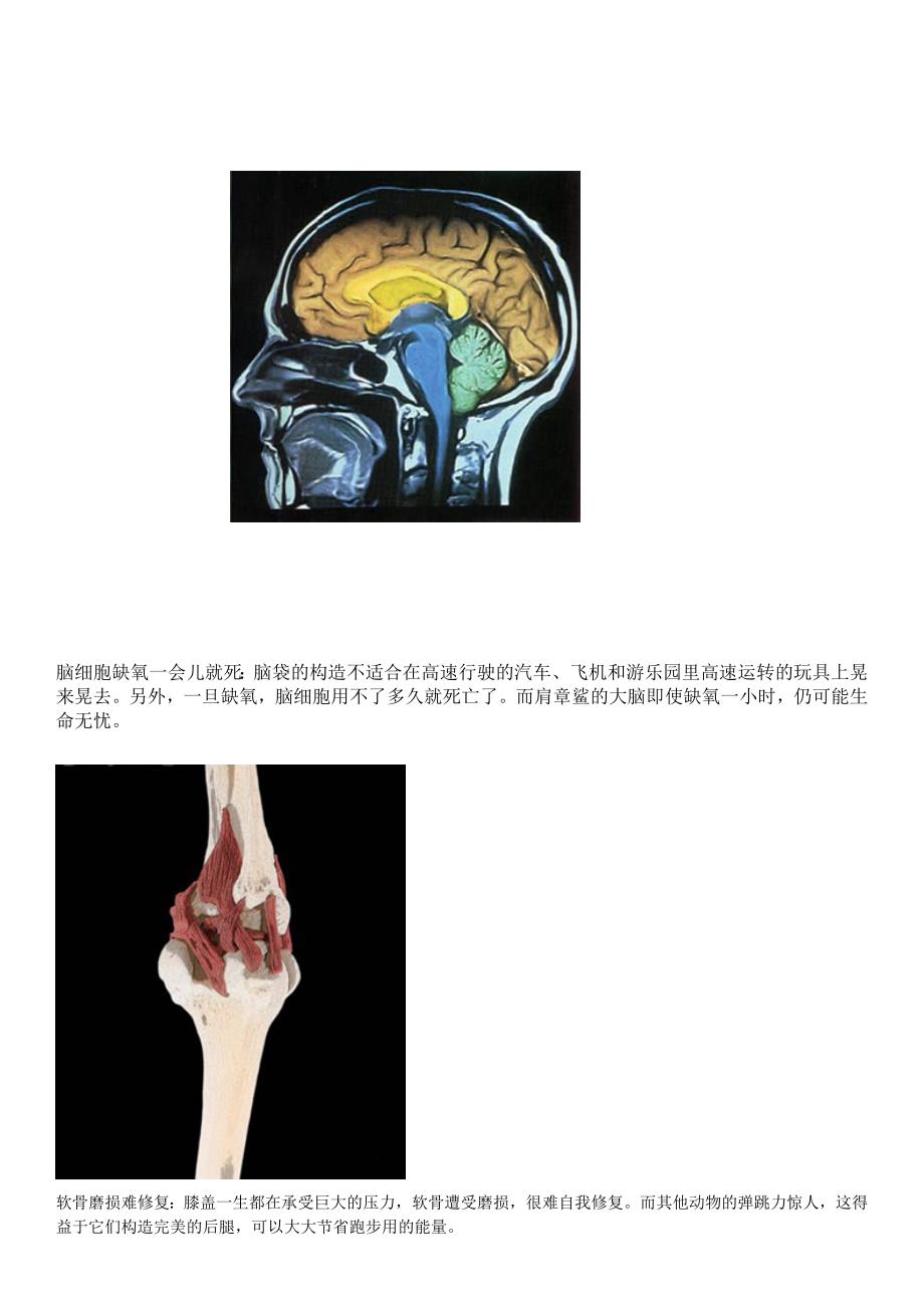 人体的10个致命缺陷部位受损难再生_第2页