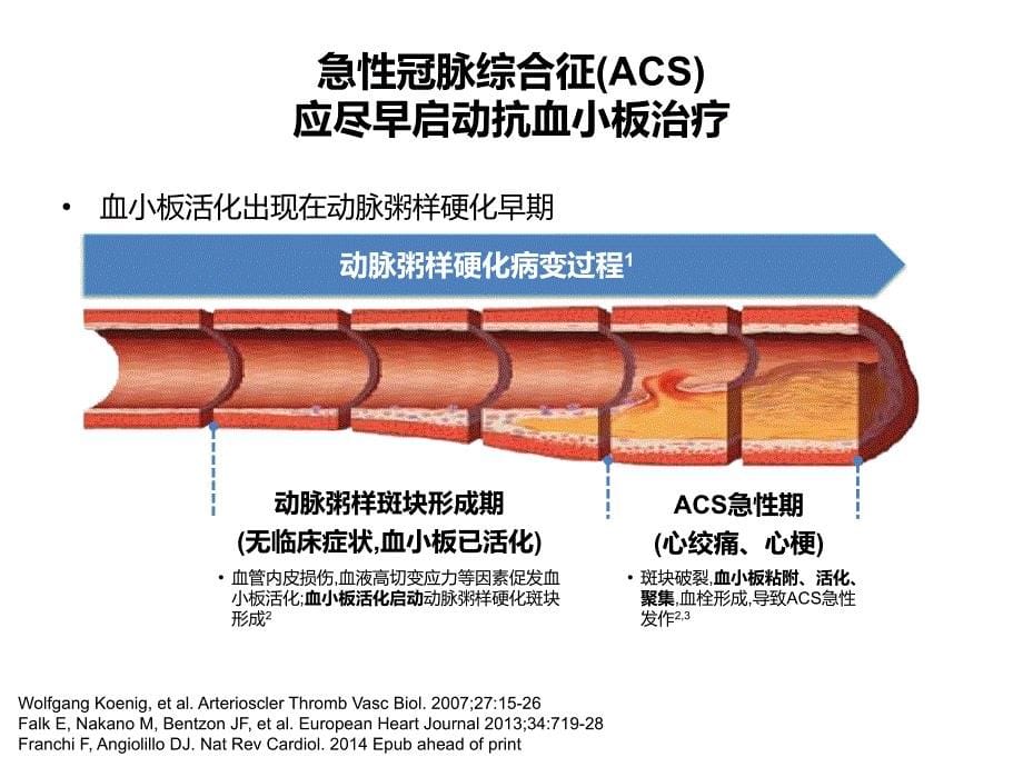 10ACS患者双抗规范化治疗_第5页