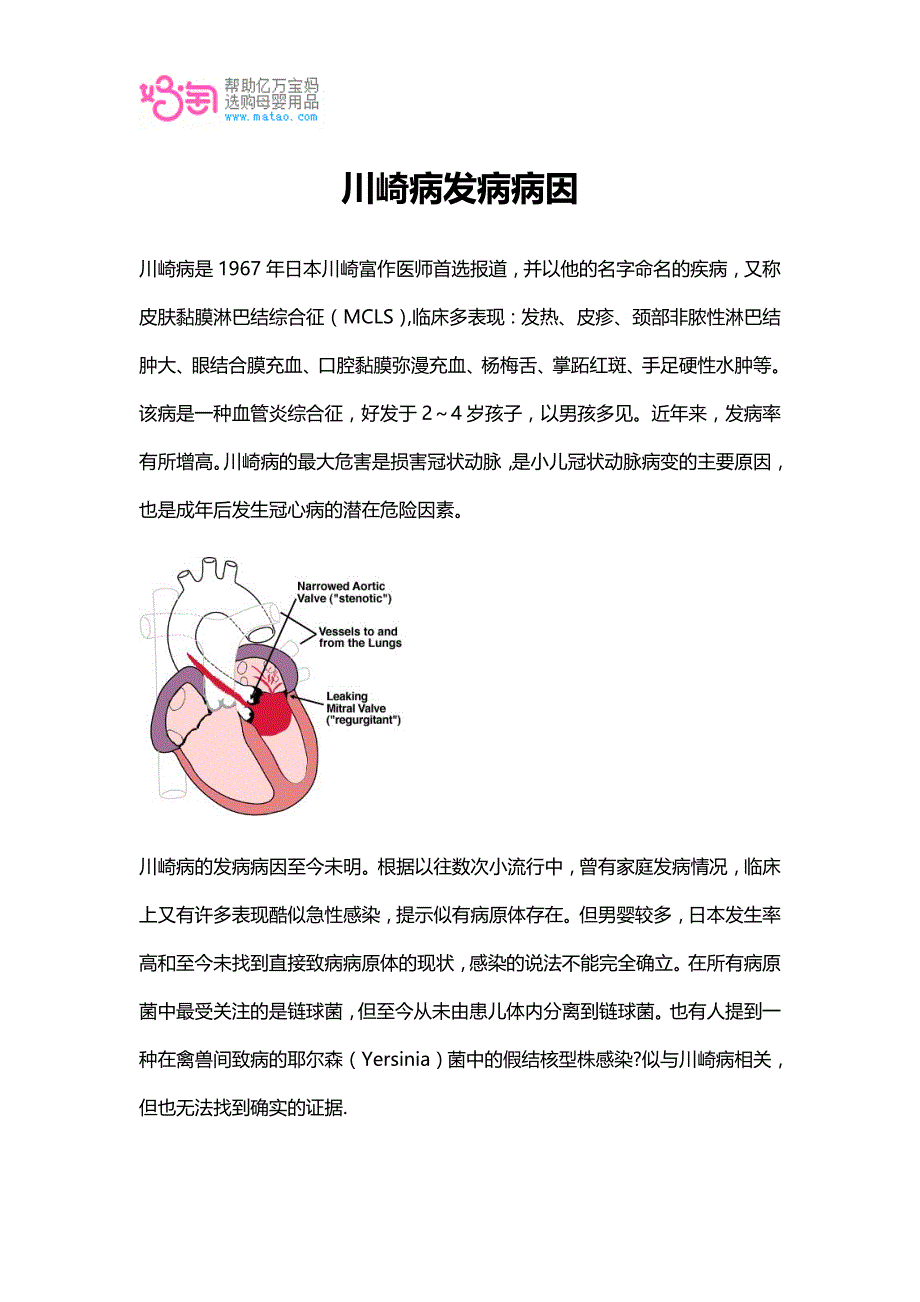 川崎病发病病因_第1页